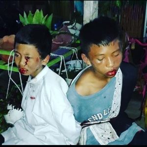 Keluarga Korban Penganiayaan Anak Dibawah Umur Berharap Dapat Keadilan